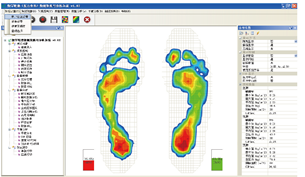 足底壓力分布測(cè)試系統(tǒng)